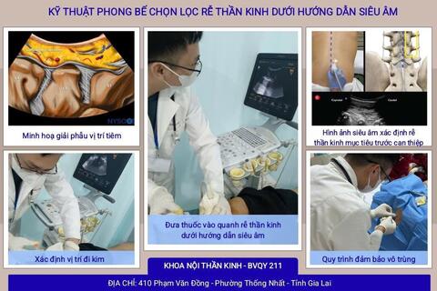 PHONG BẾ CHỌN LỌC RỄ THẦN KINH DƯỚI SIÊU ÂM