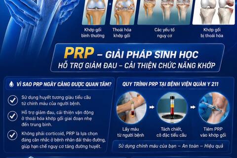 Thoái hoá khớp gối - Đừng để đau kéo dài ảnh hưởng cuộc sống